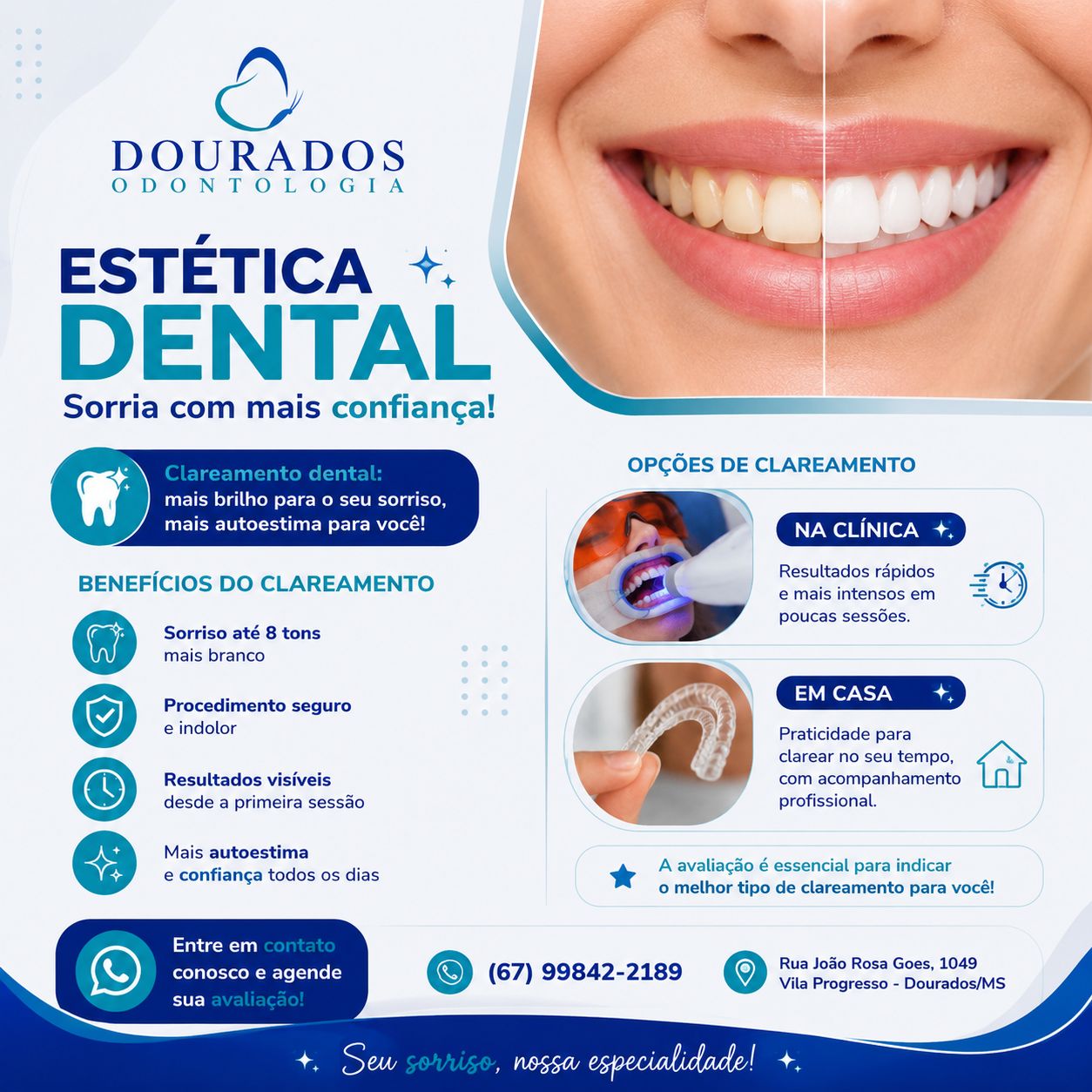 Estética Dental